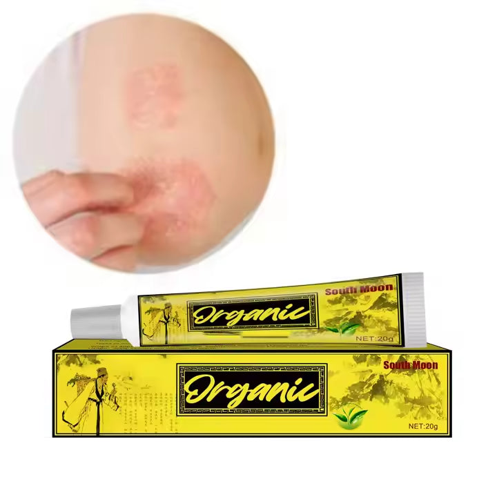 pommade organique et naturelle pour la peau – Eczéma